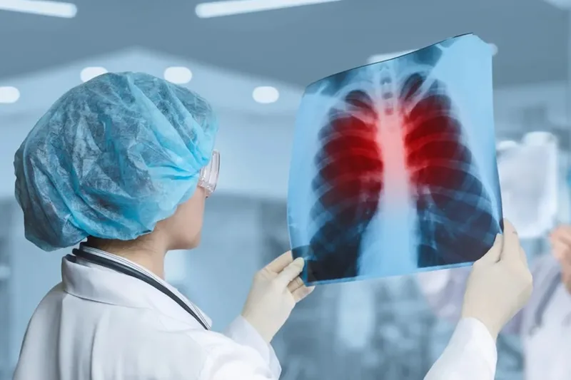 Projeto sobre hipertensão pulmonar avança na Câmara com foco em diretrizes de atendimento