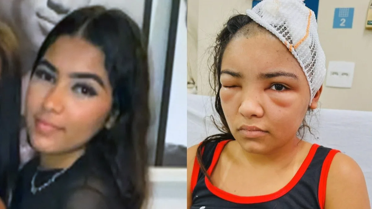 Jovem é baleada na cabeça após encontro no Rio, diz família