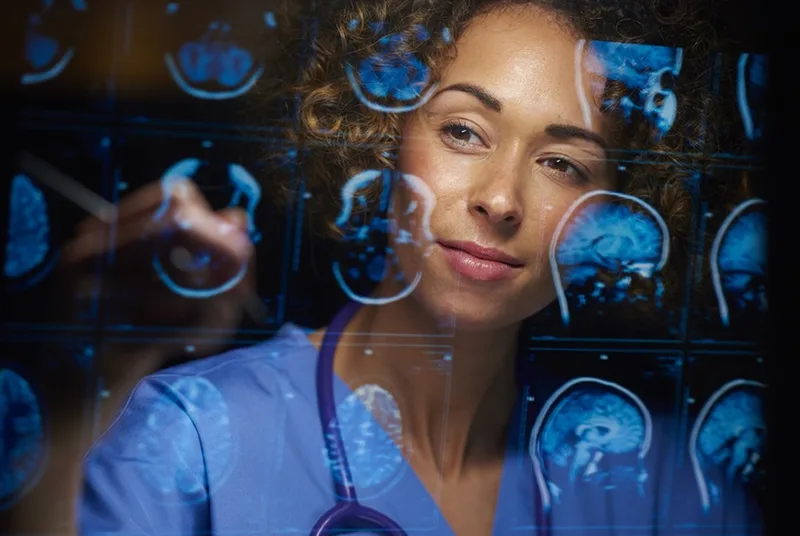 Exames de imagem molecular ajudam a identificar alterações do Alzheimer