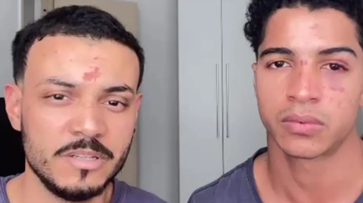 Casal denuncia agressões homofóbicas em festa de alunos da UFRJ