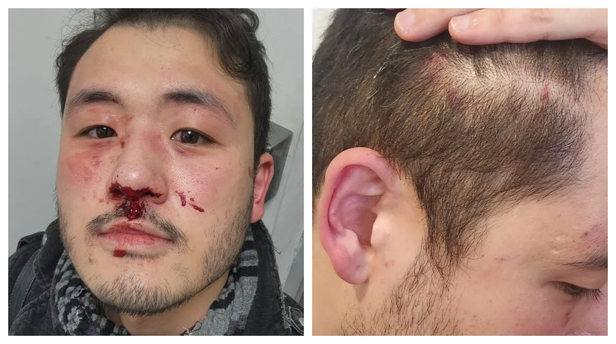Professor é agredido em estação da Linha 5-Lilás, em São Paulo