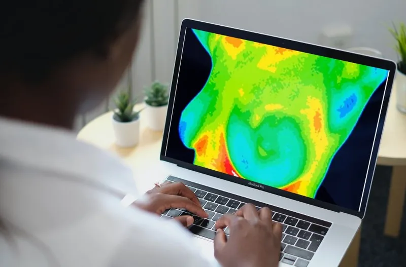 Proposta condiciona divulgação de tecnologias para rastrear câncer a três exigências